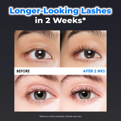 Eyelash Growth Serum, Jumbo Size 0.5fl.oz - Safe & Gentle Lashes Care, Fuller, Thicker in 2 Weeks, Non-Prostaglandin, Hormone-free